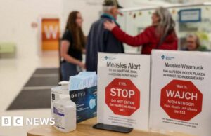 Canada verliest de status van eliminatie van mazelen, terwijl de VS op koers liggen om te volgen